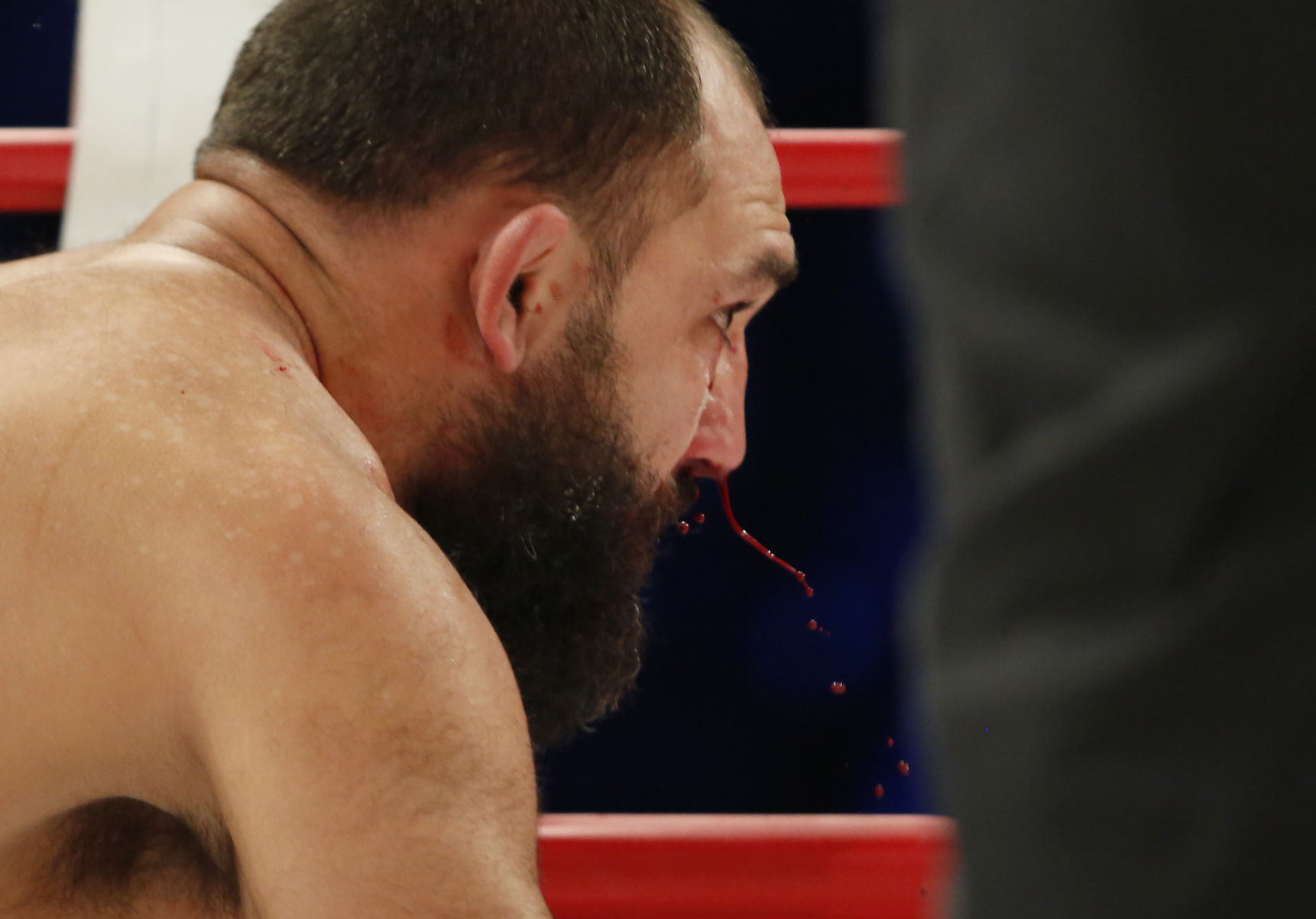 Bare Knuckle Boxing